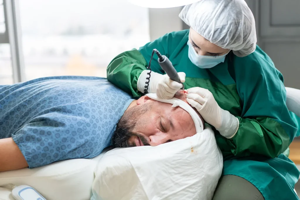 Hair Transplants- Hair Transplantation