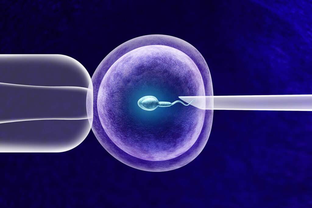 Natural IVF