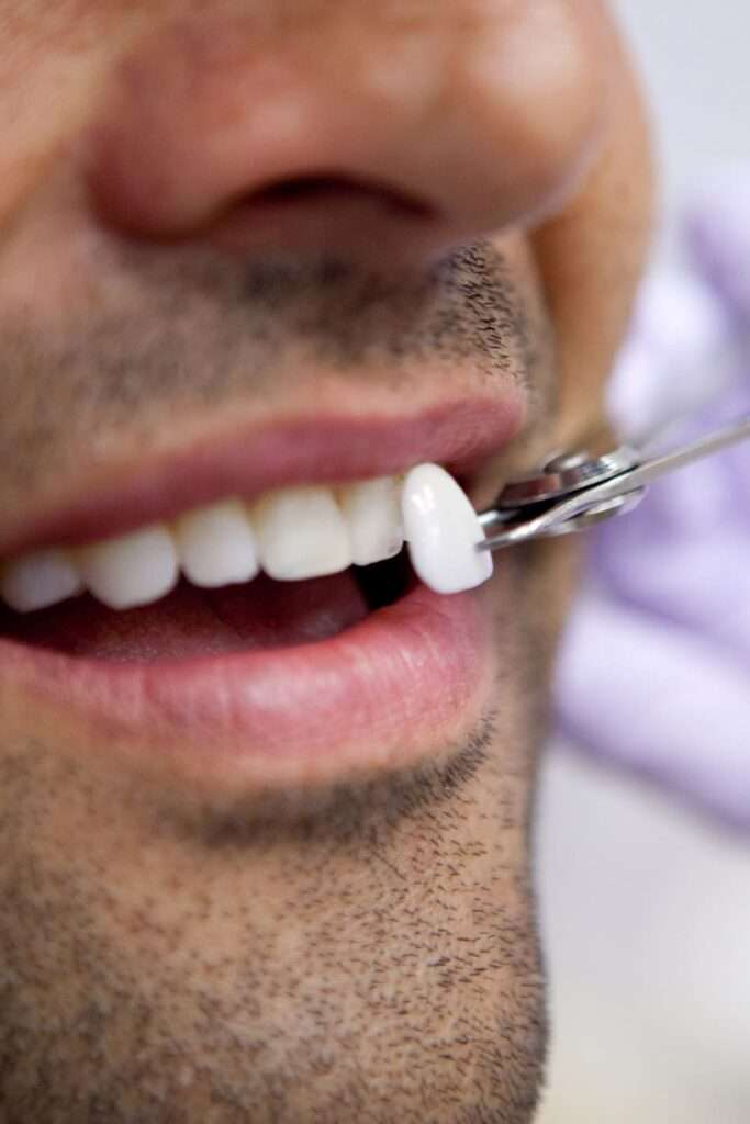 Toxin Treatments and Zirconium Dental Coating