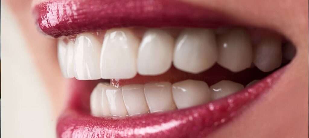 bonding applications with Wellness Voyage in Turkey