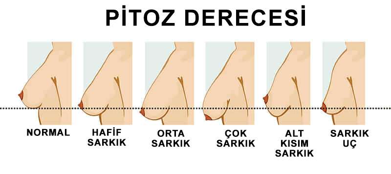 https://wellnessvoyage.us/wp-content/uploads/2025/05/breast-lift-surgery-img.jpg