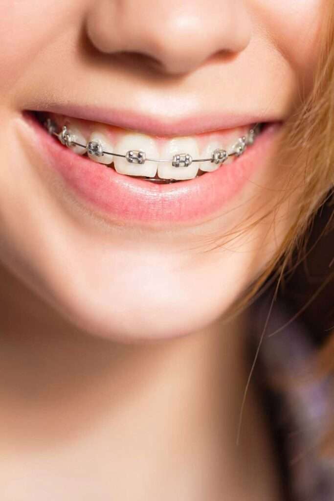Orthodontic Treatment near me