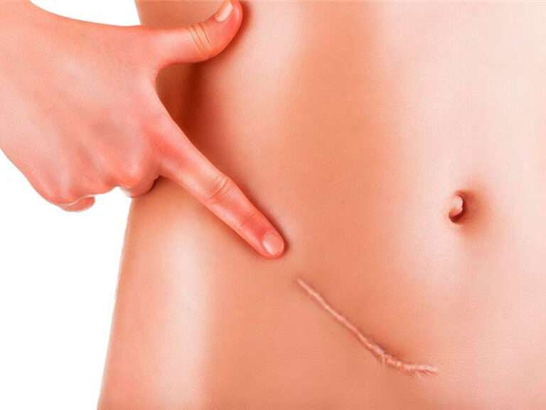 Reconstructive Surgery and scar revision treatments image